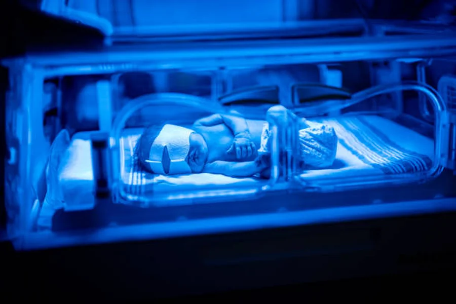 Jaundice Treatment Solutions