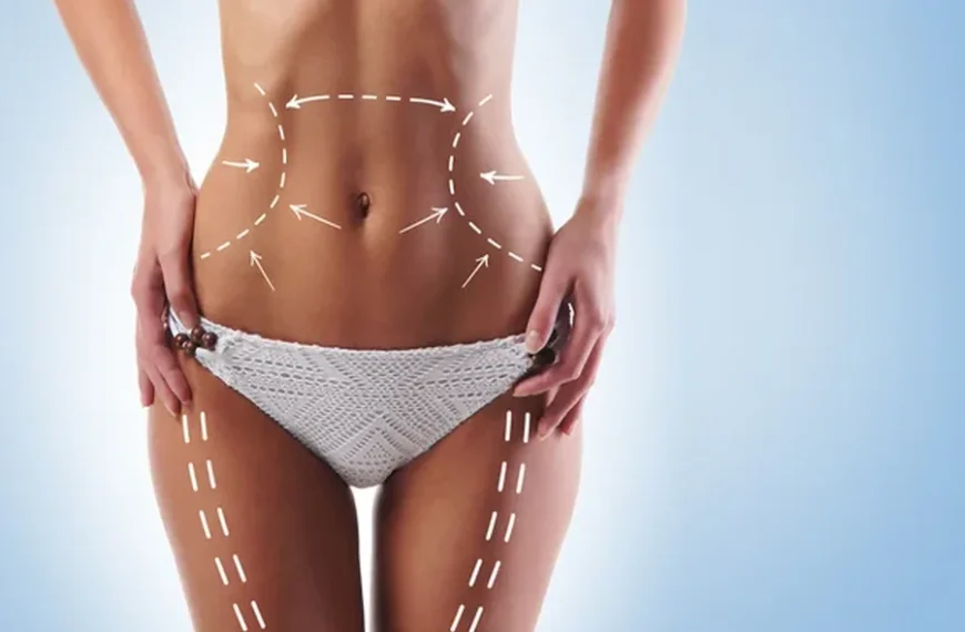 V Aesthetics Body Slim